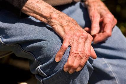 4 Ways to Help Prevent Arthritis