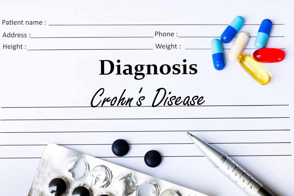 Understanding Your Crohn’s Disease Diagnosis: What to Expect